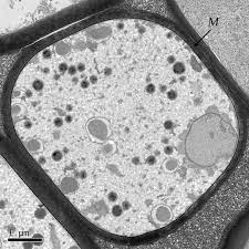 Cell Wall Micrograph