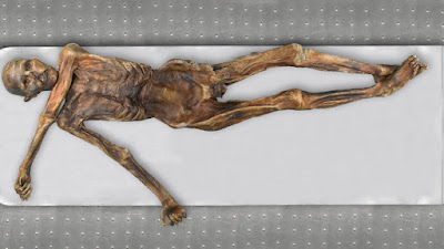 An overhead photo of the Iceman Ötzi mummy lying on a white table.