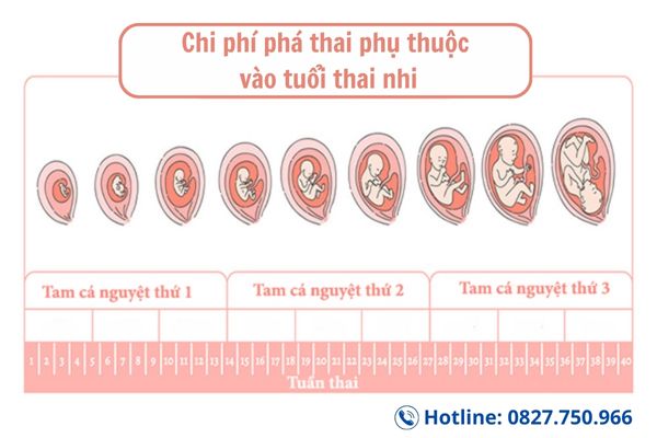 Chi phí phá thai phụ thuộc vào tuổi thai nhi