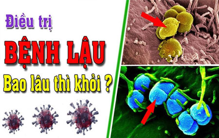 Bệnh lậu điều trị bao lâu thì khỏi? Tìm hiểu thời gian và phương pháp hiệu quả