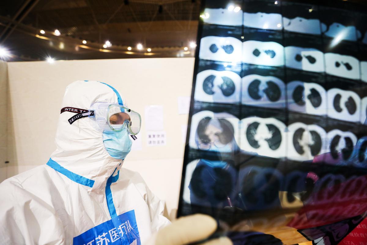 Một bác sĩ quan sát bản chụp CT của bệnh nhân tại một bệnh viện tạm thời được thành lập dành cho bệnh nhân COVID-19 trong một sân vận động thể thao ở Vũ Hán, tỉnh Hồ Bắc, miền trung Trung Quốc, ngày 05/03/2020. (Ảnh: STR/AFP qua Getty Images)
