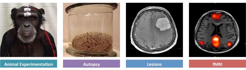 brain identification