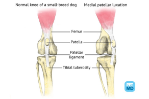 Obrázek 6: Zdravý kolenní kloub a kloub postižený MPL (6) 