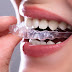 What Is Invisalign, Often Known as Invisible Orthodontics?