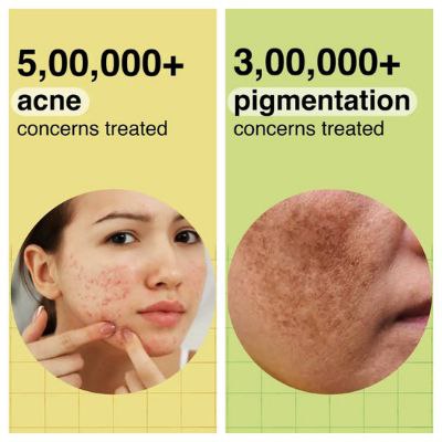 monitorar a saúde de sua pele