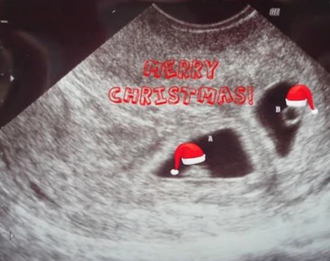 Christmas Pregnancy Announcement Ultrasound 
