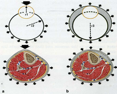 Illustrazione 13 - Chirurgia Vascolare