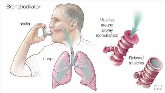 Mayo Clinic Q and A: COPD treatment with two types of bronchodilators -  Mayo Clinic News Network