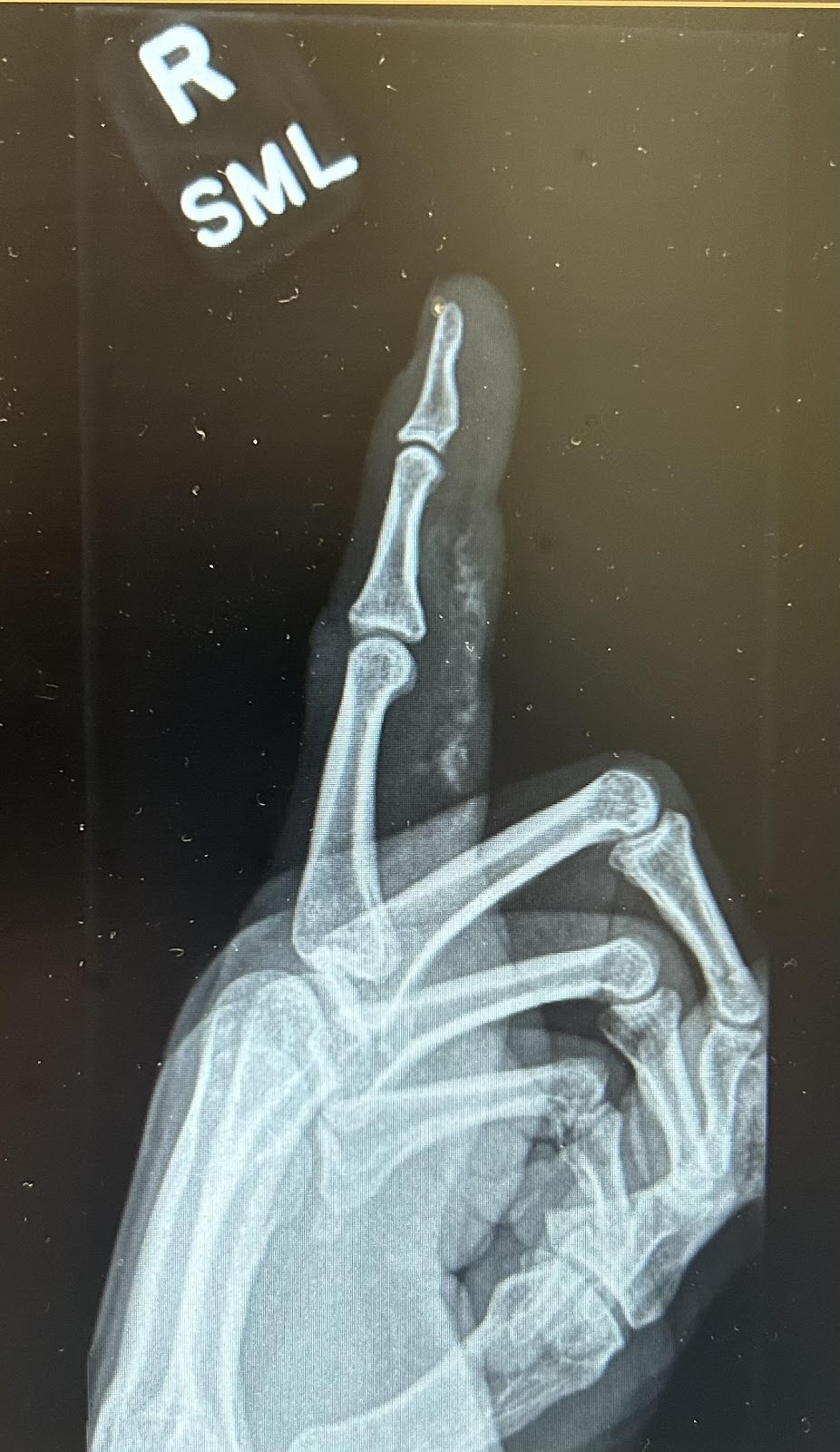 X-ray of a hand

Description automatically generated