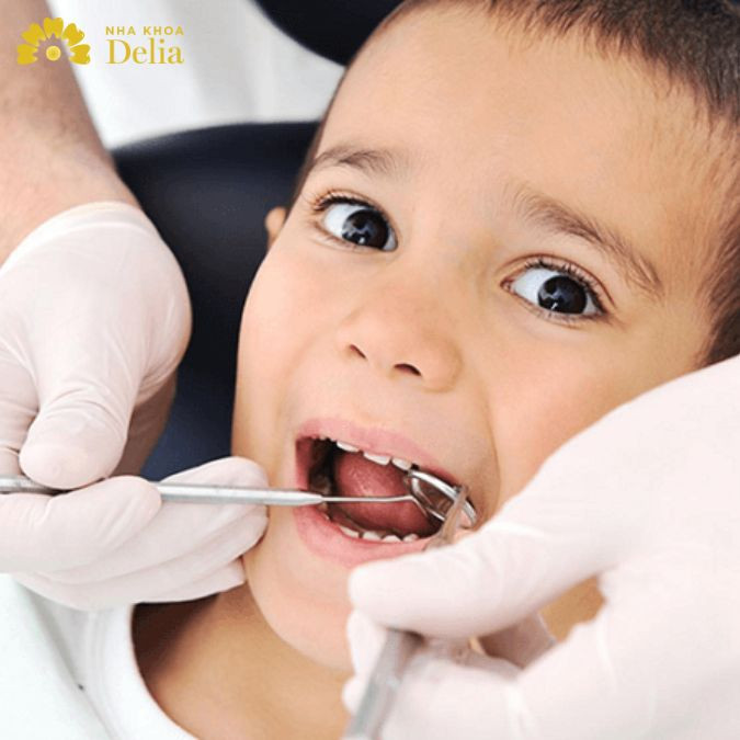 Trẻ đã trải qua quá trình thay toàn bộ răng sữa có thể bọc răng sứ