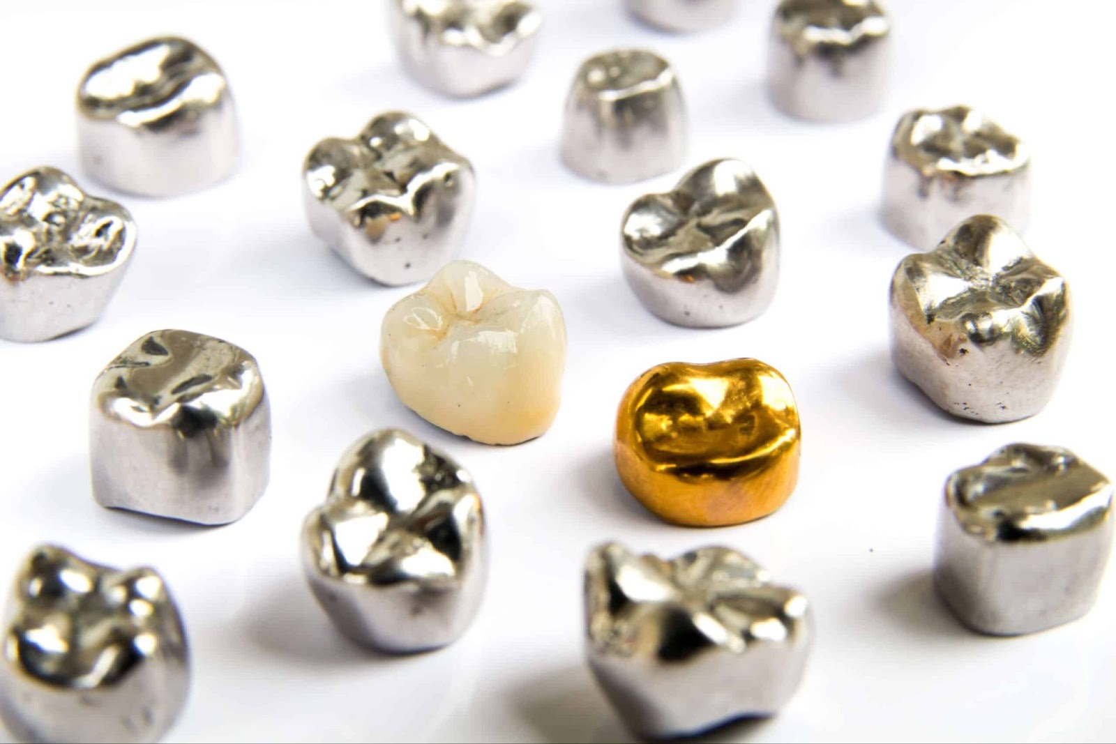 Identifying the Need for a Dental Crown