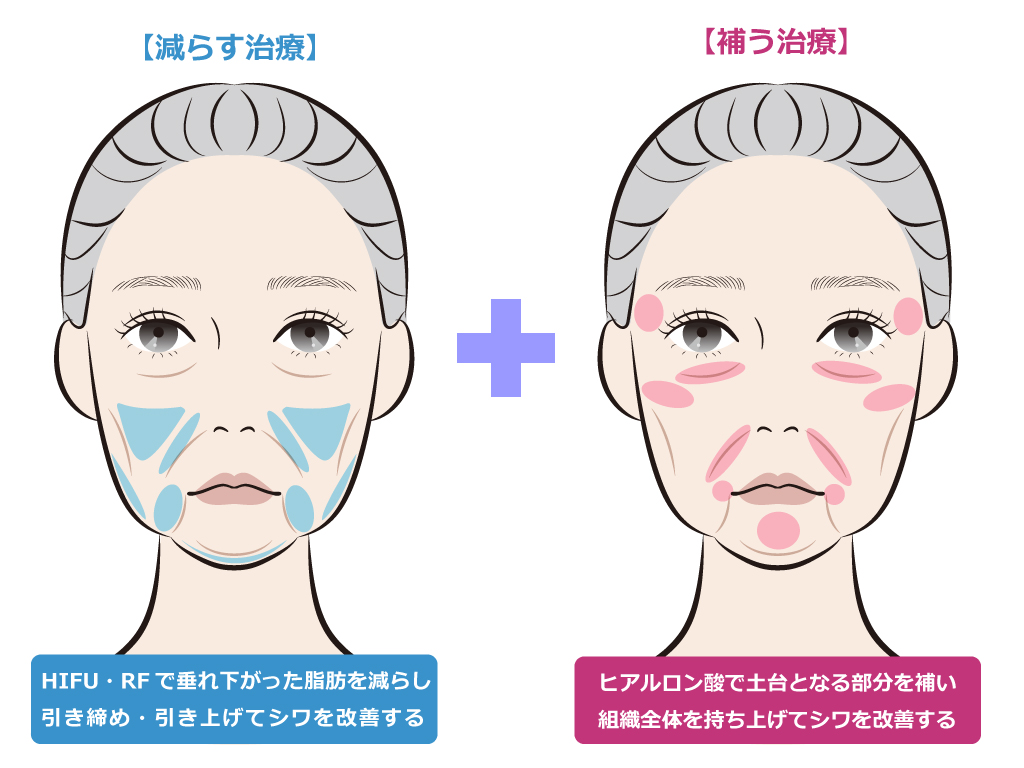 【たるみ】減らす治療・補う治療