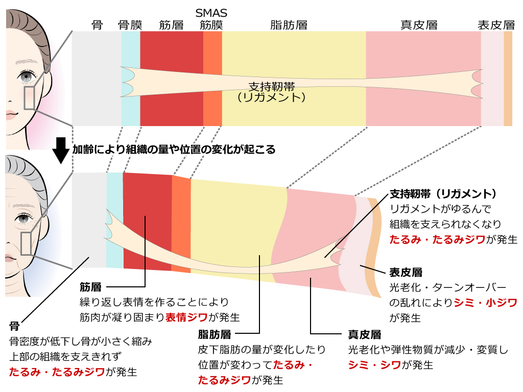 加齢による皮下組織の変化