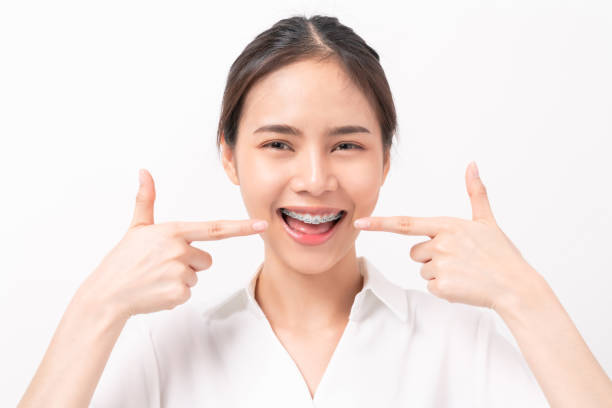 Braces: Confident