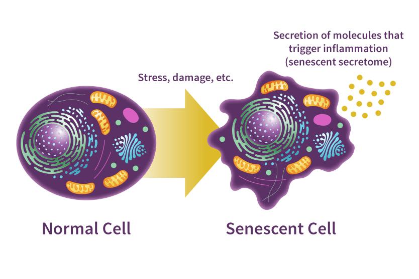 Does cellular senescence hold secrets for healthier aging? | National  Institute on Aging