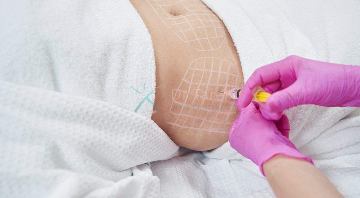 Are Lipo Injections Effective