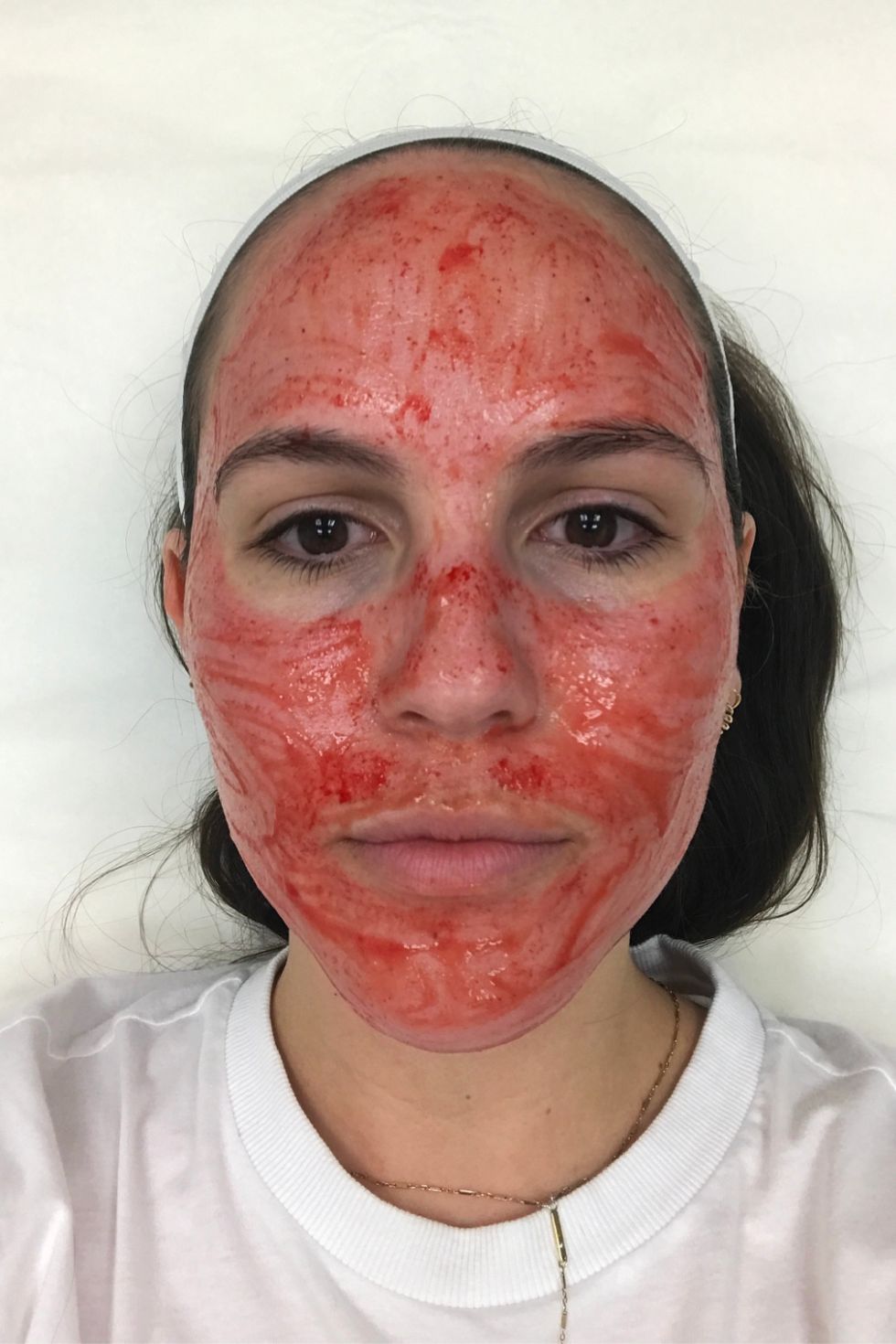 During Pro Facial 1