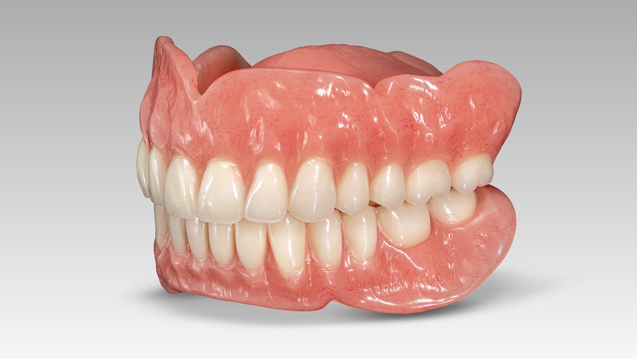 How to Update Our Permanent Denture?