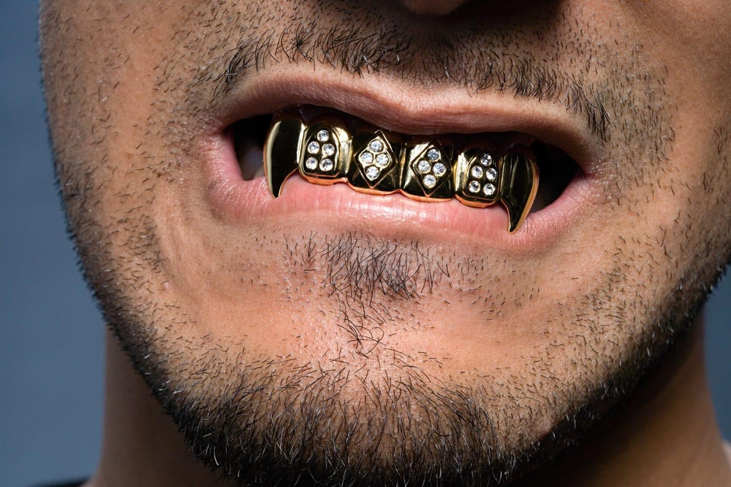 The Ultimate Guide to Diamond Bar Grillz  