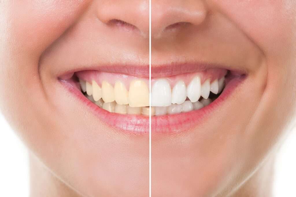 Confident Smile Healthy You
