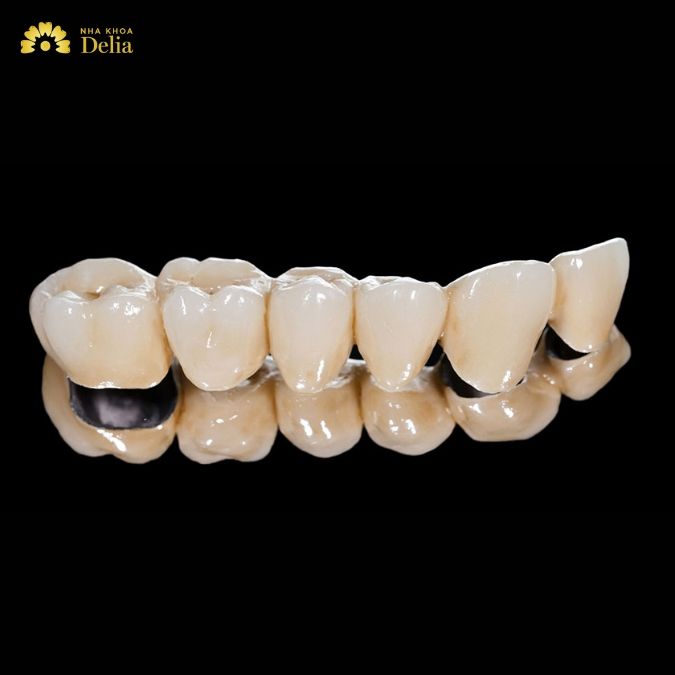 Răng sứ Trung Quốc giá rẻ có phải là răng sứ kém chất lượng?