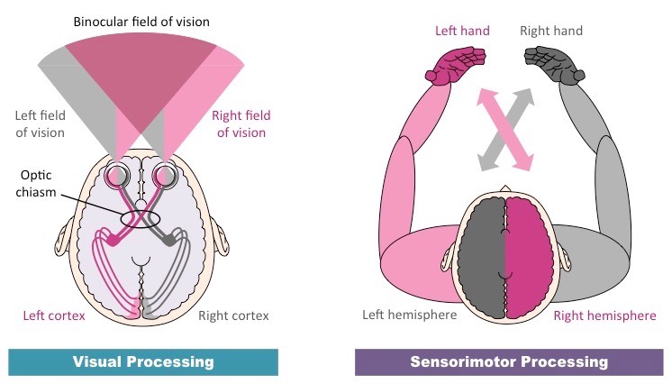 contralateral processing