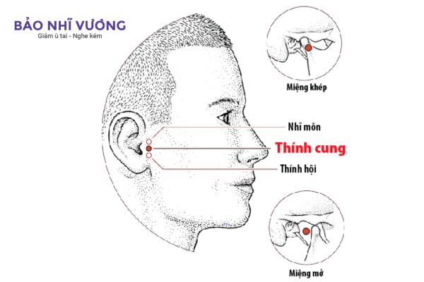 huyet-thinh-hoi-chua-u-tai