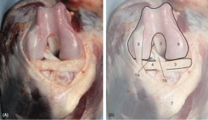 Obrázek 2: Zobrazení kolenního kloubu v mírné flexi v kraniálním pohledu.
