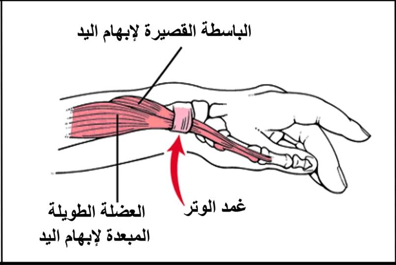 E:\Documents and Settings\USER\Desktop\كبار السن\توضيح اجزاء ديكرفين.jpg