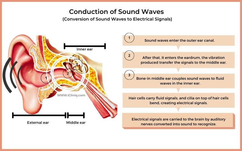 auditory-nerve