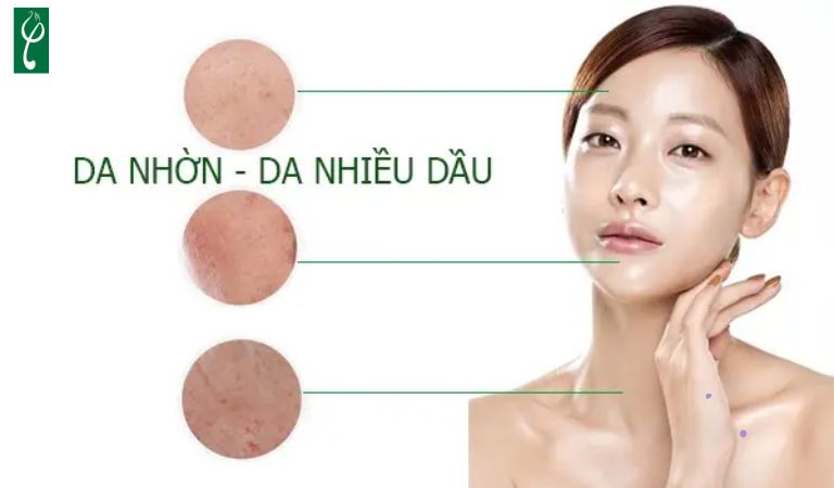 Da dầu gồm có 4 loại chính