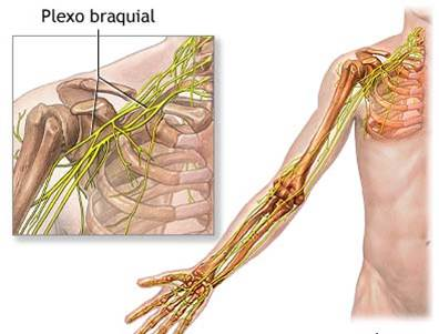 Desenho gráfico da musculatura e raízes nervosas no plexo braquial (nervo que liga a região do pescoço até a axila)