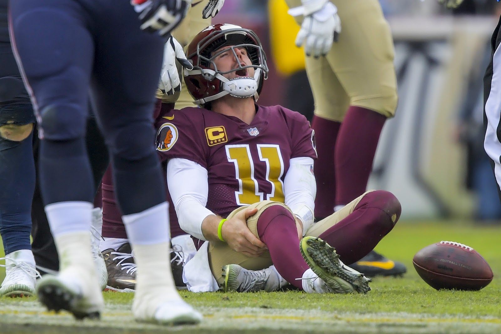 Redskins' Alex Smith dealing with surgical complications from ...