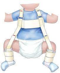 Caring for Your Child in a Pavlik Harness