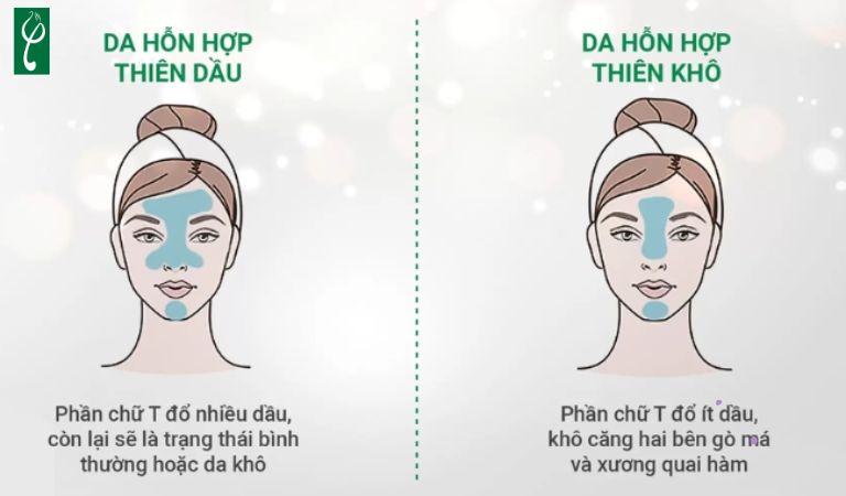 Đặc điểm nhận biết da hỗn hợp thiên dầu hay thiên khô