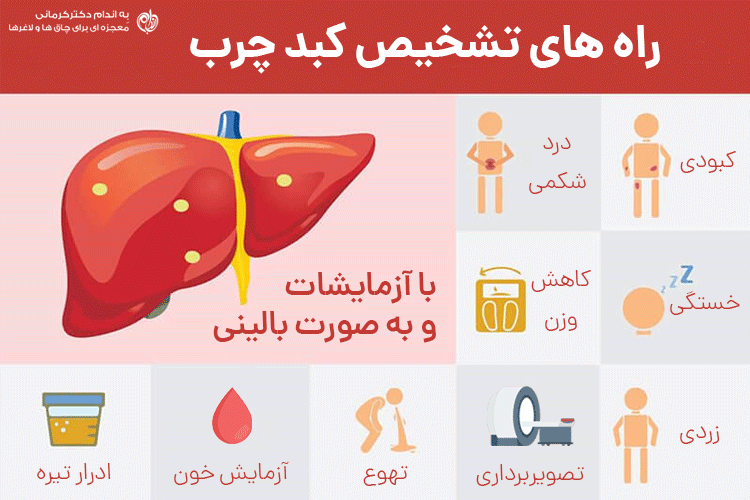 راه های تشخیص کبد چرب چیست؟