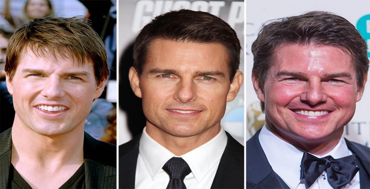 What has Tom Cruise done to his face?' Actor sparks plastic surgery riddle  at BAFTAs – The Sun | The Sun