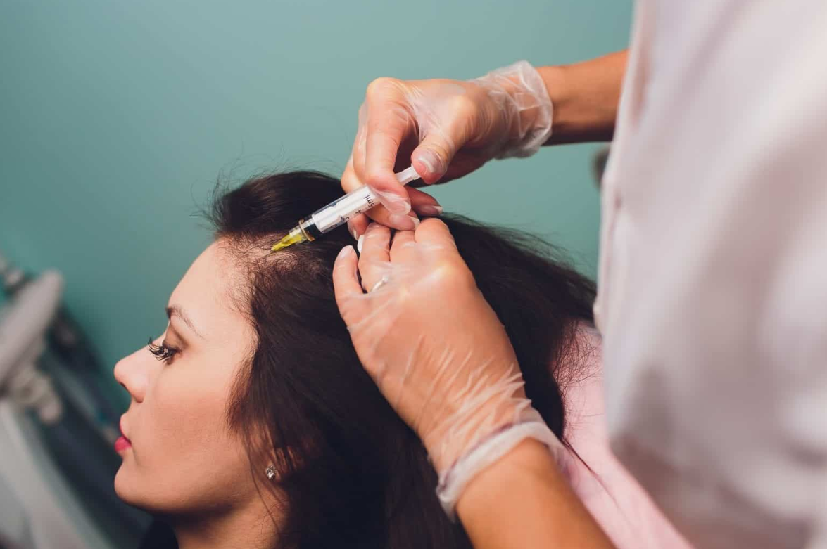 A woman getting a PRP injection in her scalp. 