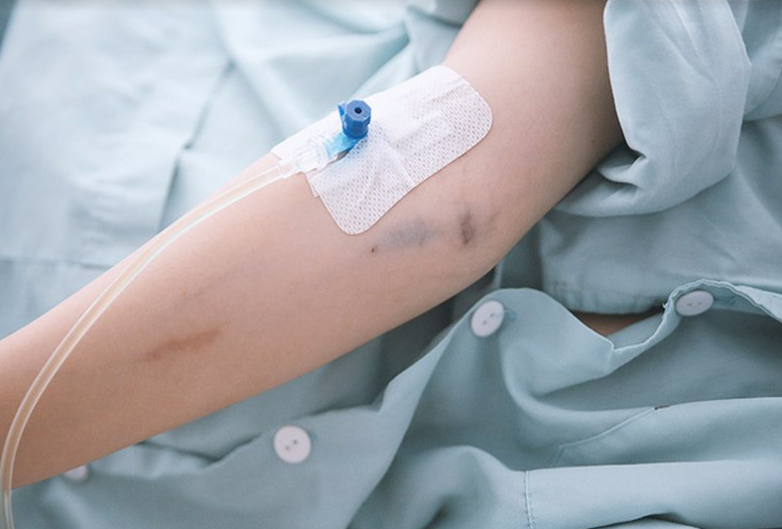 Để xử trí sốc sốt xuất huyết Dengue, bệnh nhân có thể sẽ được chỉ định truyền dịch