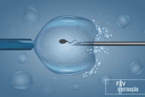 Fertilização In vitro ilustração