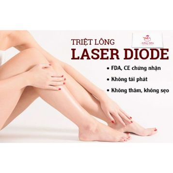 phuong-phap-triet-long-laser