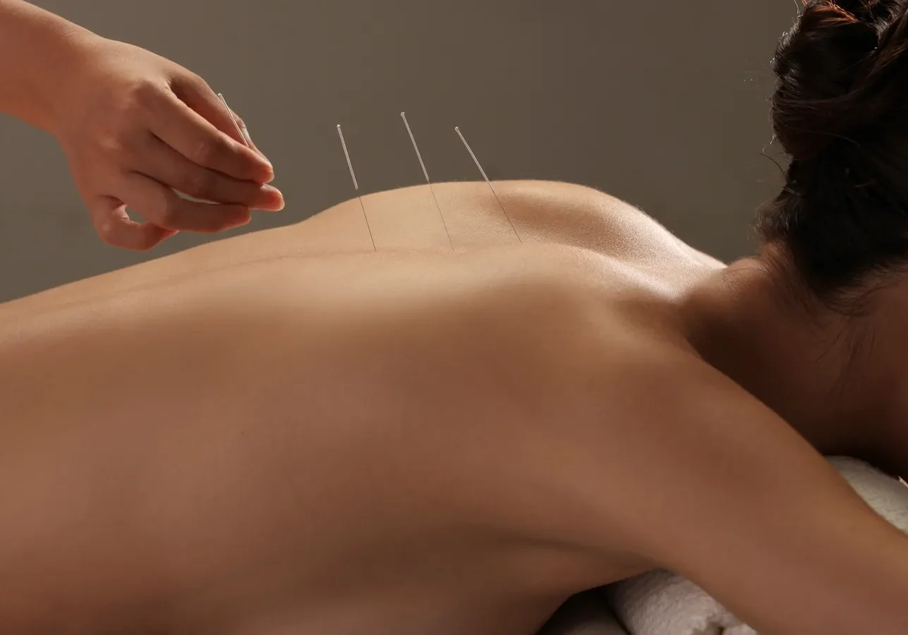 flawlеss skin with thе hеlp of Korеan Acupuncturе