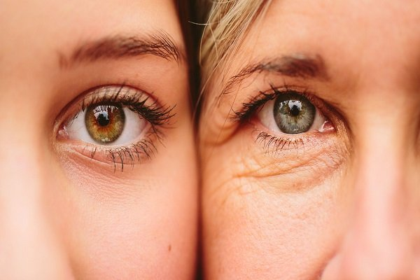 REMOVE EYE WRINKLES ACCORDING TO EXPERT ADVICE