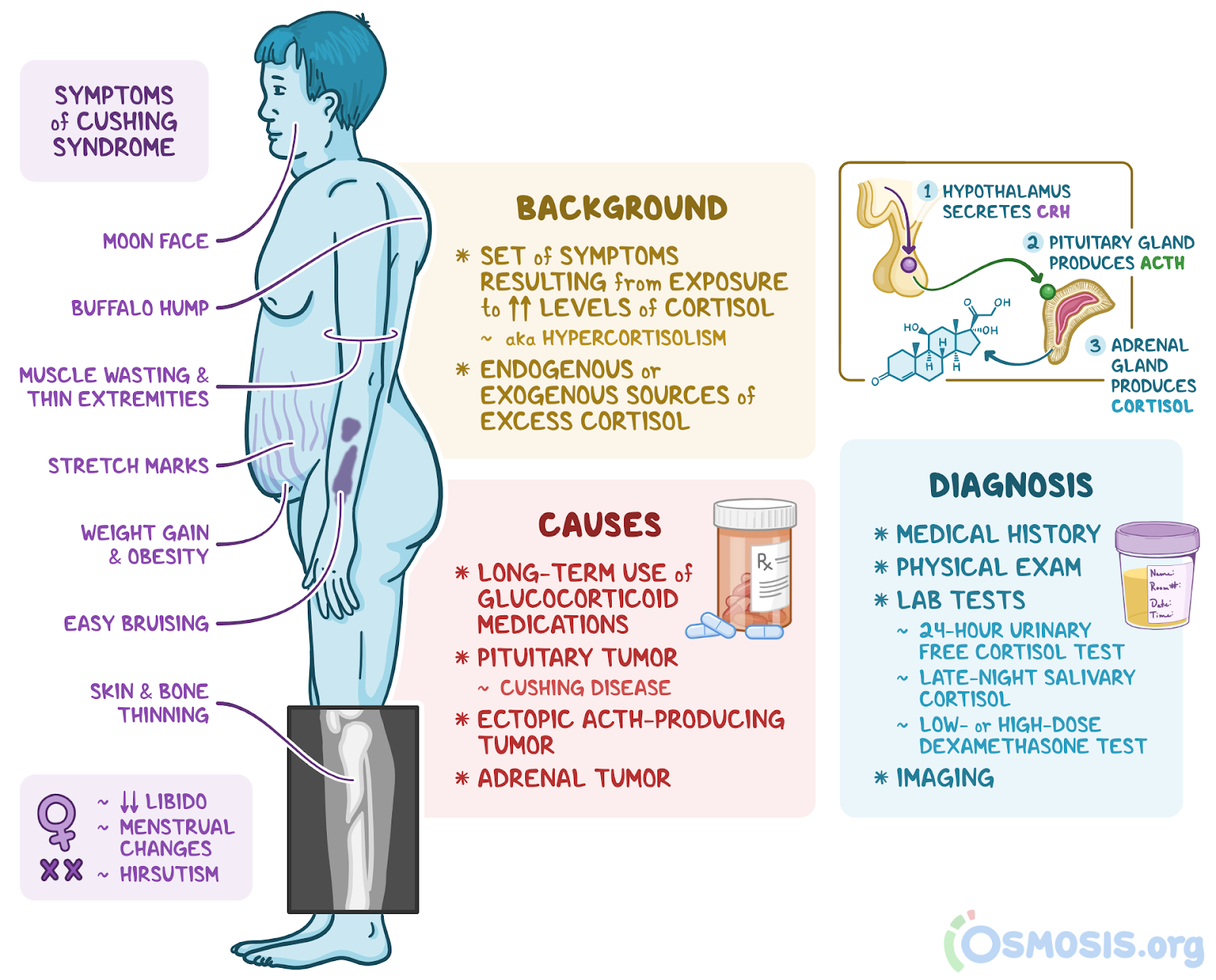 Cushing Syndrome: What is It, Causes, Treatment, and More | Osmosis