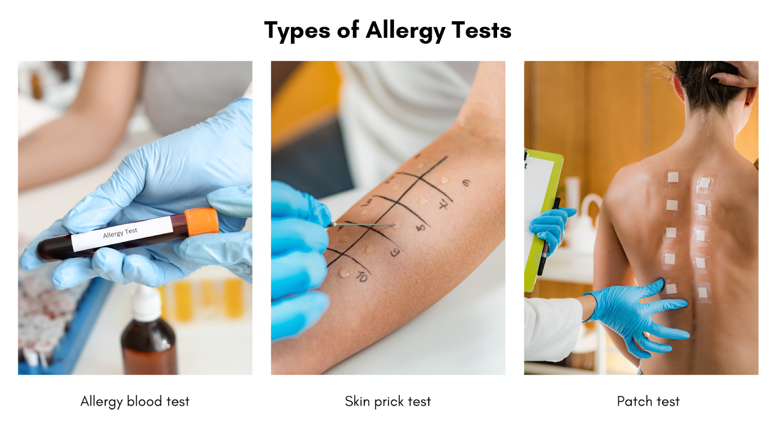 Types of allergy testing