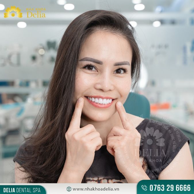 Niềng răng là phương pháp chỉnh lại những hàm răng khuyết điểm