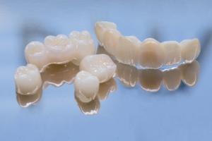 Răng toàn sứ là một trong các loại răng sứ bền đẹp nhất