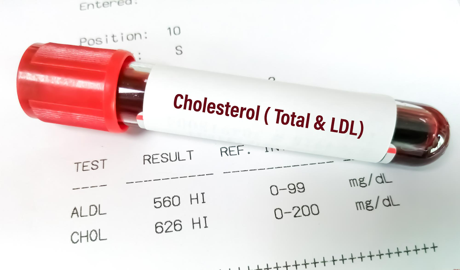 Tipi di colesterolo e fattori che influiscono su di esso