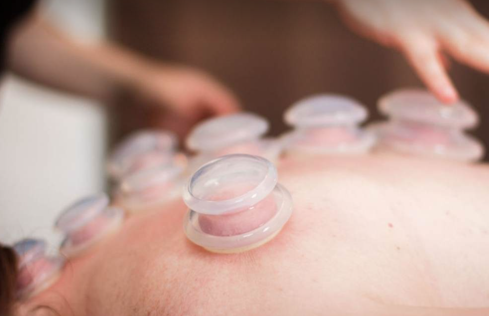 cupping therapy massage