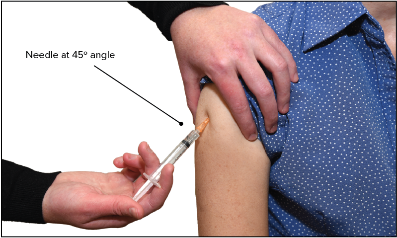 Figure. Subcutaneous injection into the deltoid area | The Australian  Immunisation Handbook